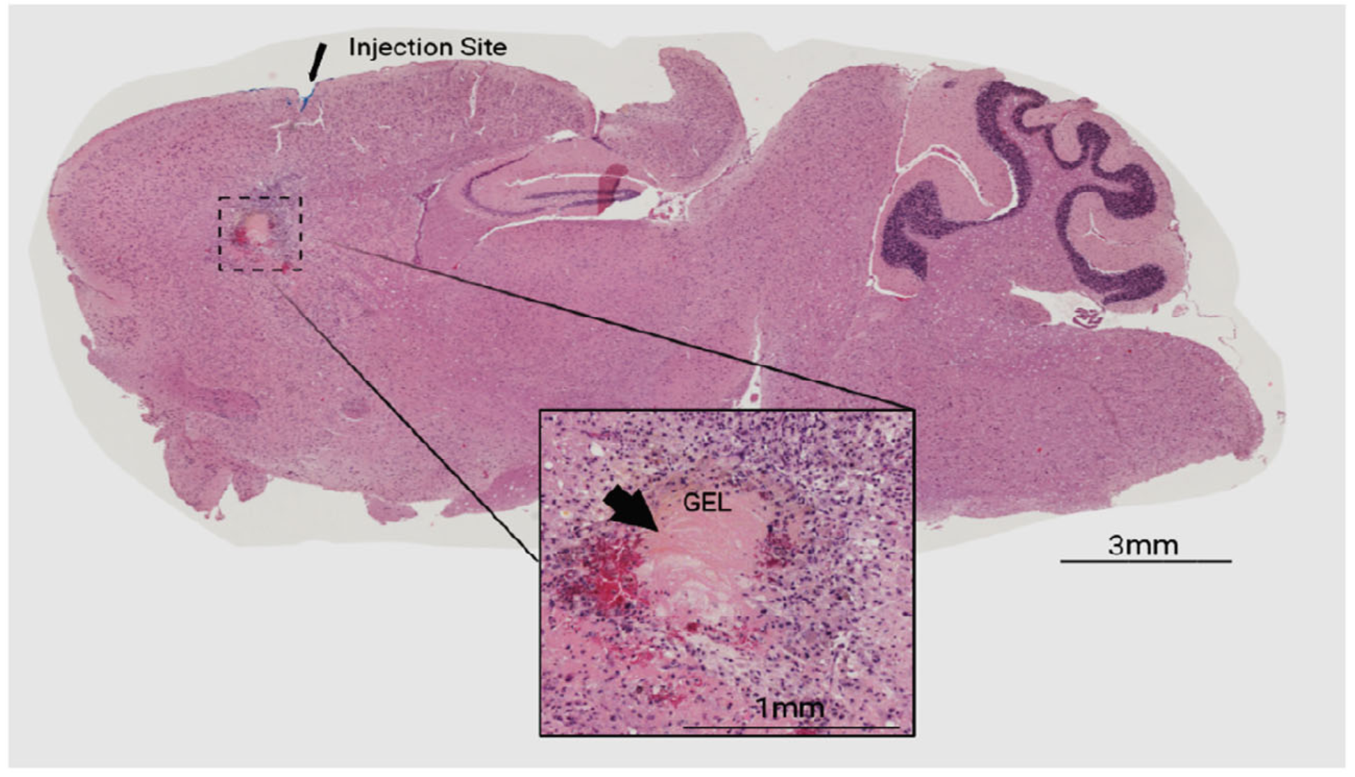 ersatile Tissue-Injectable Hydrogels Capable of the Extended Hydrolytic Release of Bioactive Protein Therapeutics